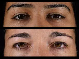 New Study Challenges Link Between Plant-Based Diets and Longevity, Experts Sound Alarm