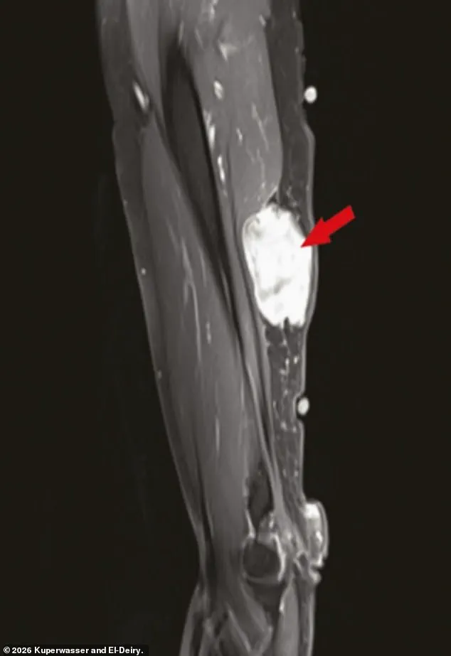 Cyberattack on Journal Hosting Cancer-Vaccine Study Sparks Public Health Concerns