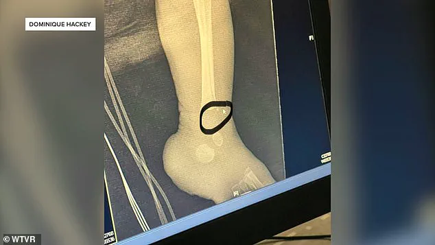 Henrico NICU Nurse Pleads No Contest to Nine Felony Child Abuse Charges After Newborns Found with Unexplained Fractures