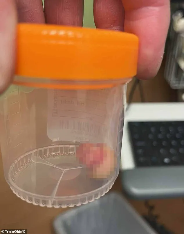 Minneapolis Protests Turn Violent Following Fatal Federal Agent Shooting