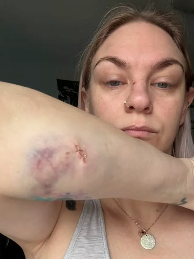 Brutal Attack by Escaped Bulldogs in Oshawa Leaves Two Mothers and Child Injured, Owners Unbothered by Chaos
