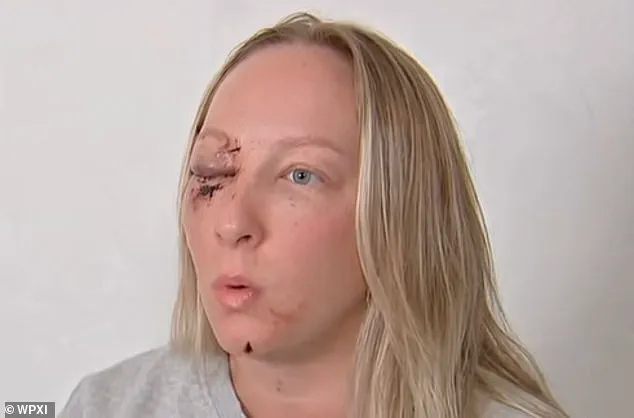 Near-Fatal Collision on Parkway West: Mother and Daughter Shaken as Ice From Tractor-Trailer Shatters Windshield