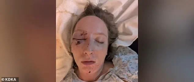 Near-Fatal Collision on Parkway West: Mother and Daughter Shaken as Ice From Tractor-Trailer Shatters Windshield