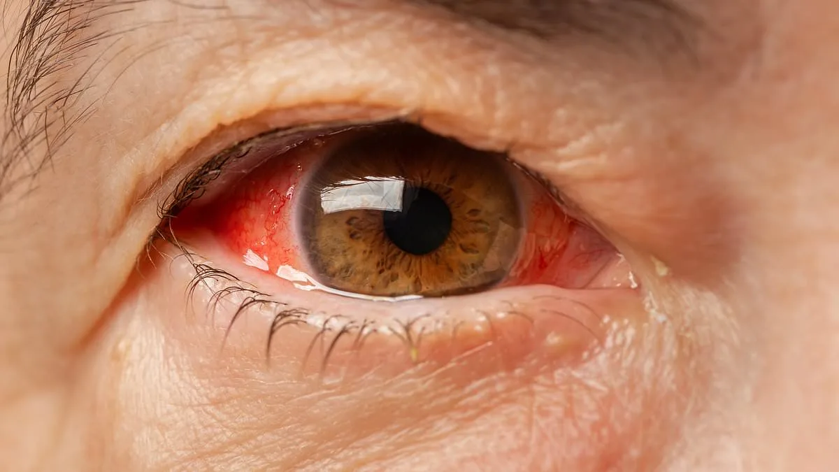 Hidden Battleground in Ugandan Cave Reveals Pathway for Deadly Marburg Virus to Leap to Humans