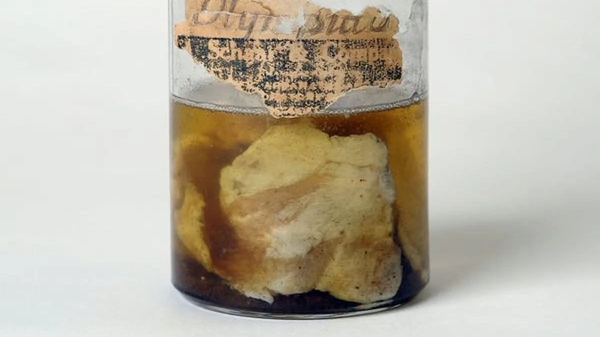 Meat Raining from the Sky: The Kentucky Meat Shower