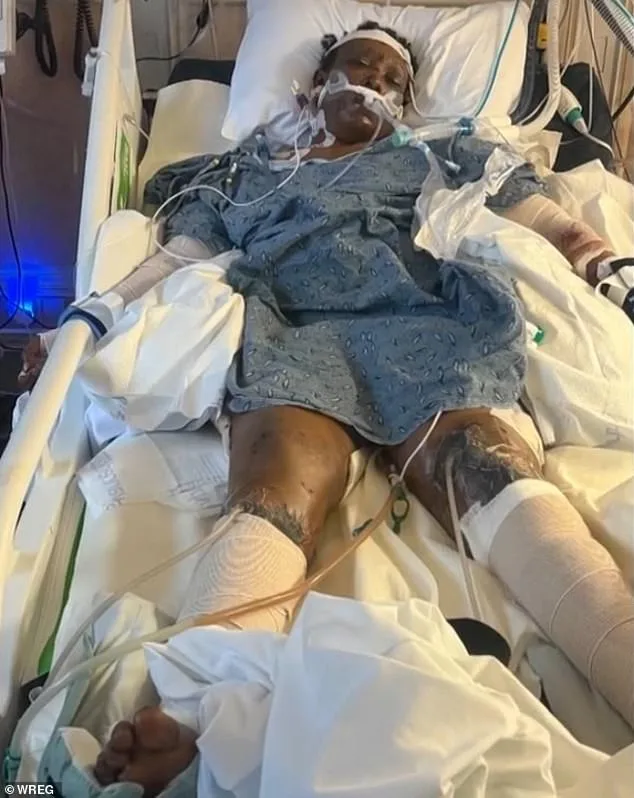 Mississippi Woman Dies After Brutal Dog Attack Sparks Outcry Over Public Safety