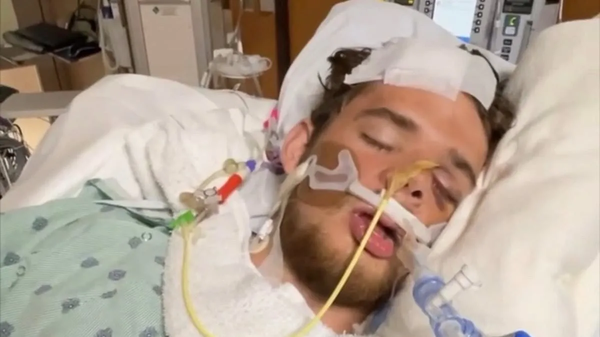 Miraculous Survival: Gabe Poirot Defies Death After Devastating Skateboard Accident