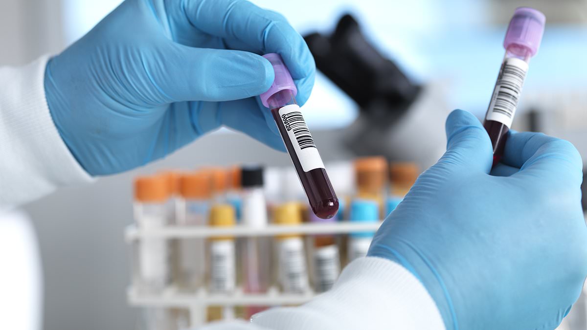 New Galleri blood test could prevent one in five UK cancer deaths annually.