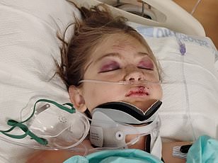 Idaho woman loses legs after propeller accident but survives with help.
