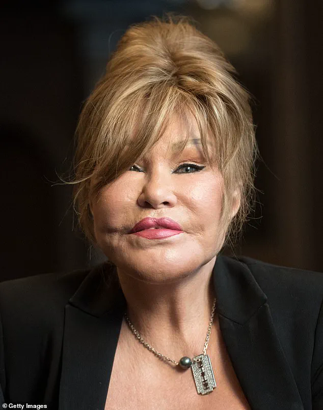 Unveiling Jocelyn Wildenstein's Life Through Her Personal Photos