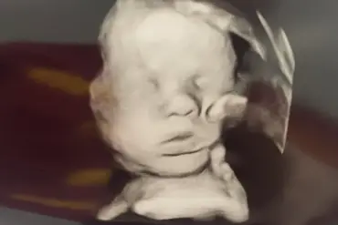Miracle in the Womb: Amanda Foster's Ultrasound Image Sparks Global Conversation About Faith and Medical Miracles