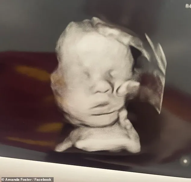 Miracle in the Womb: Amanda Foster's Ultrasound Image Sparks Global Conversation About Faith and Medical Miracles