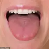 Exclusive Insights: How the Tongue Reveals Health Clues and Why Expert Access Matters for Public Health