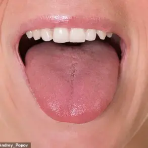 Exclusive Insights: How the Tongue Reveals Health Clues and Why Expert Access Matters for Public Health