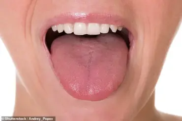 Exclusive Insights: How the Tongue Reveals Health Clues and Why Expert Access Matters for Public Health