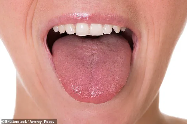 Exclusive Insights: How the Tongue Reveals Health Clues and Why Expert Access Matters for Public Health