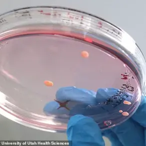 Breakthrough in Down Syndrome Research: CRISPR-Cas9 Technique Sparks Debate Over Ethical Implications