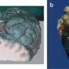 Exclusive Insights: Methylene Blue's Altered Organ Color Revealed in Study, Expert Advisories Warn Against Unverified Health Claims
