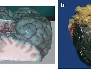 Exclusive Insights: Methylene Blue's Altered Organ Color Revealed in Study, Expert Advisories Warn Against Unverified Health Claims