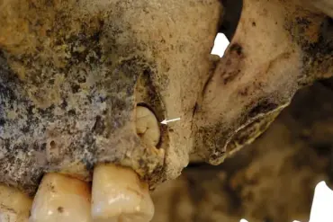 Late-Breaking Discovery: Stone Age Sisters' Sacrifice Unearthed in Czech Republic, Offering Insight into Ancient Rituals