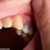 Oral Health as a Window to Systemic Wellness: How Dental Innovations Are Enhancing Early Disease Detection