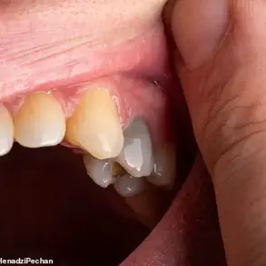 Oral Health as a Window to Systemic Wellness: How Dental Innovations Are Enhancing Early Disease Detection