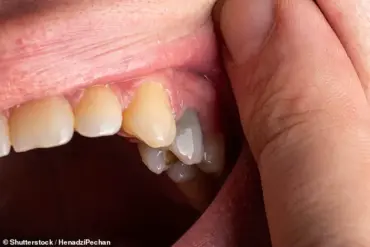 Oral Health as a Window to Systemic Wellness: How Dental Innovations Are Enhancing Early Disease Detection