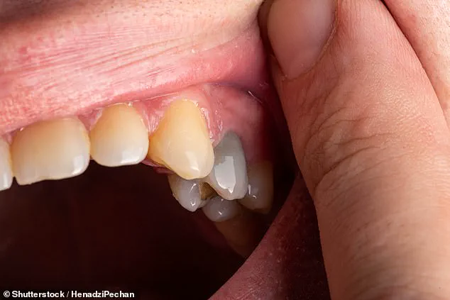 Oral Health as a Window to Systemic Wellness: How Dental Innovations Are Enhancing Early Disease Detection