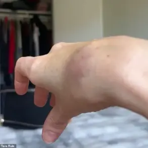 Limited Access to Medical Information Sparks Airline Dispute Involving Influencer with EDS