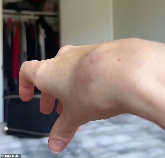 Limited Access to Medical Information Sparks Airline Dispute Involving Influencer with EDS